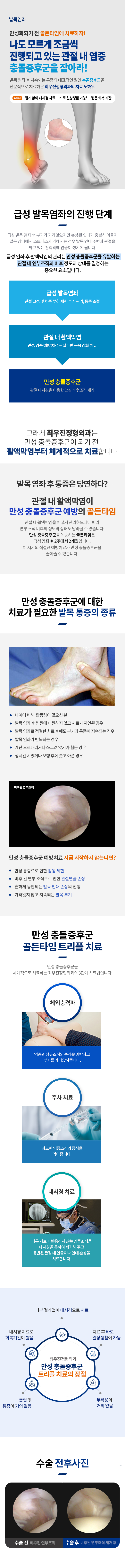 급성발목염좌