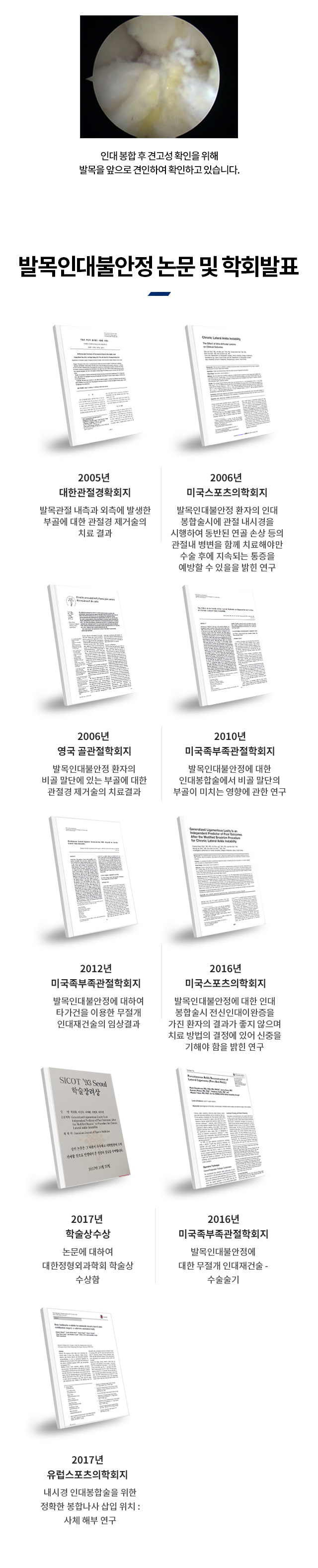 만성 발목인대불안정